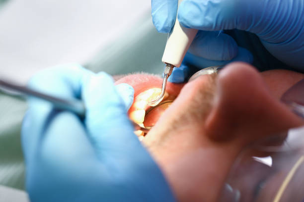 Best Mobile Emergency Dentist in Fountain Green, UT