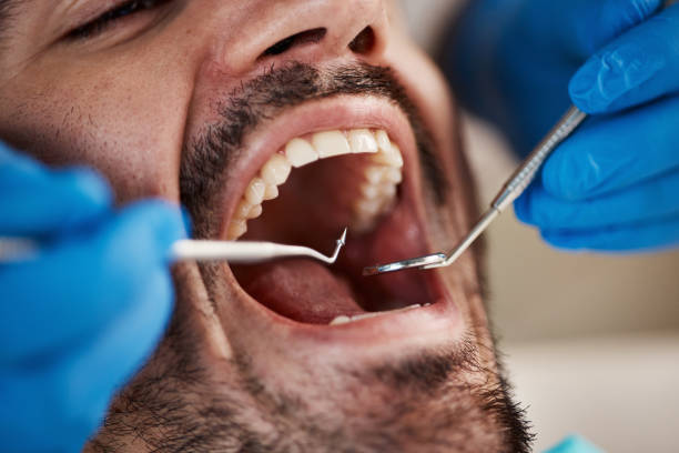 Best Broken or Cracked Tooth Emergency Dentist in Fountain Green, UT