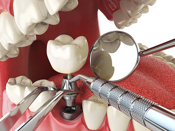 Best Broken or Cracked Tooth Emergency Dentist in Fountain Green, UT